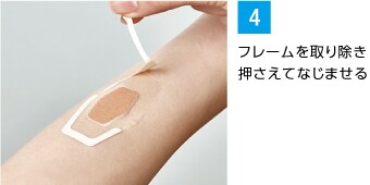 フレームを取り除き押さえてなじませる
