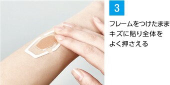 フレームをつけたままキズに貼り全体をよく押さえる
